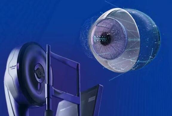 顺德首批全光塑病例已完成手术!顺德爱尔揭秘应用“全光塑”个性化屈光矫正手术 顺德首批全光塑病例已完成手术!顺德爱尔揭秘应用“全光塑”个性化屈光矫正手术